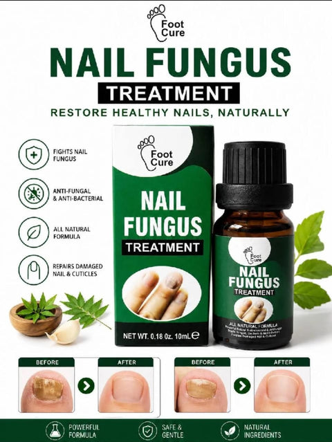 Nail Fungus Solution – 10ml [BUY 1 GET 1 FREE]