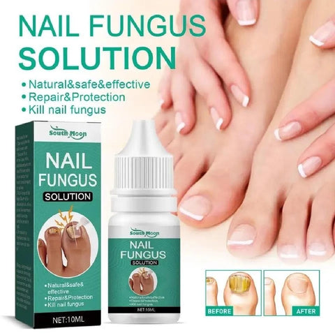 Nail Fungus Solution – 10ml [BUY 1 GET 1 FREE]