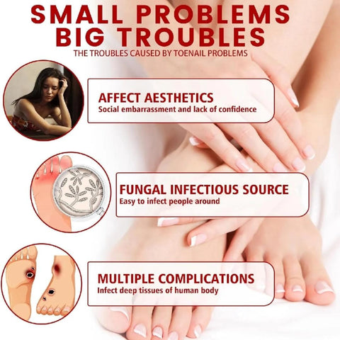 Nail Fungus Solution – 10ml [BUY 1 GET 1 FREE]